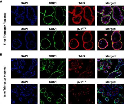 Perfluoroalkyl Substance Exposure and the BDNF Pathway in the Placental Trophoblast